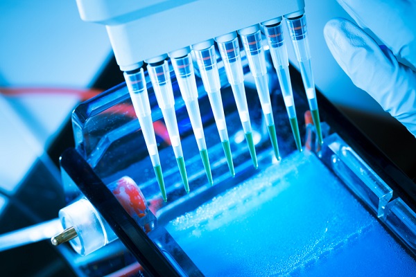 Electrophoresis Reagents Market